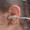 Vagal Ear Clip attached to ear showing correct tragus placement for tVNS